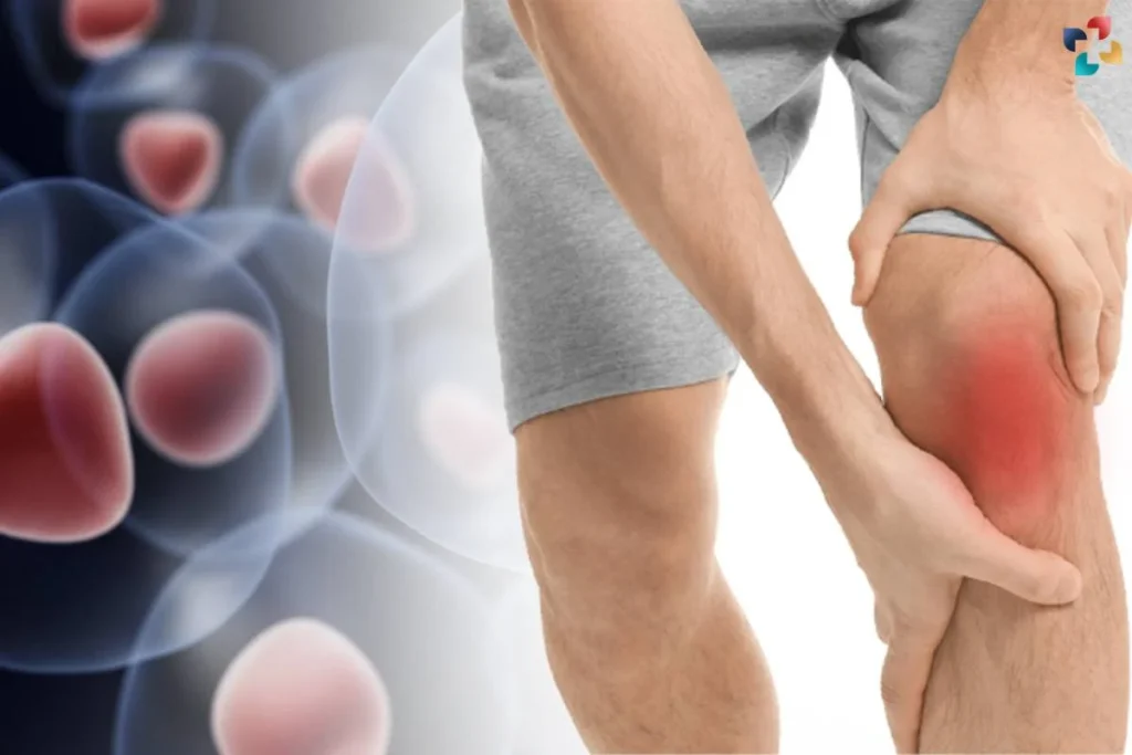 stem cell therapy for knees