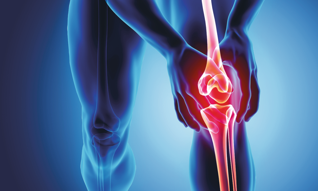 Stem Cell Therapy For Knees